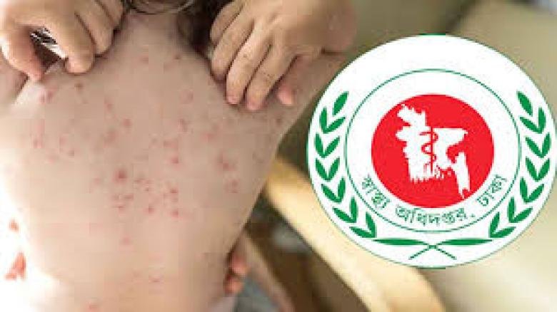 হাম ও হামের উপসর্গ নিয়ে ১০ জনের মৃত্যু...
